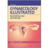 Gynaecology Illustrated