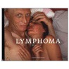 Lymphoma