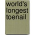 World's Longest Toenail