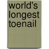 World's Longest Toenail door Susan Knight