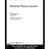 Brachial Plexus Injuries