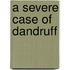 A Severe Case Of Dandruff