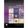 An Atlas of Induced Sputum by R. Djukanovic