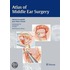 Atlas Of Middle Ear Surgery