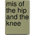 Mis Of The Hip And The Knee