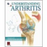 Q&A Understanding Arthritis by Scientific Publishing