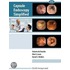 Capsule Endoscopy Simplified