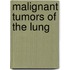 Malignant Tumors of the Lung