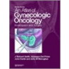 Atlas Of Gynecologic Oncology by Mrcog Smith J. Richard