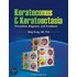 Keratoconus And Keratoectasia