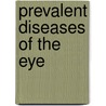 Prevalent Diseases of the Eye door Samuel Theobald