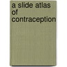 A Slide Atlas Of Contraception door Pramilla Senanayake