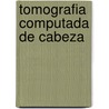 Tomografia Computada de Cabeza by Radu