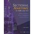 Sectional Anatomy By Mri And Ct