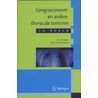 Longcarcinoom en andere thoracale tumoren door M. Wouters