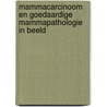 Mammacarcinoom en goedaardige mammapathologie in beeld by T. Wobbes