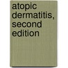 Atopic Dermatitis, Second Edition door Bieber Thomas