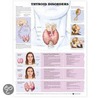 Thyroid Disorders Anatomical Chart by Unknown