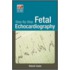 Step-By-Step Fetal Echocardiography