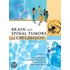 Brain and Spinal Tumors of Childhood