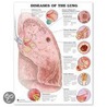 Diseases Of The Lung Anatomical Chart by Anatomical Chart Company