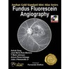Mini Atlas of Fluorescein Angiography door Yogesh Shetty