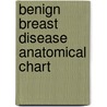 Benign Breast Disease Anatomical Chart door Onbekend