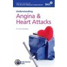 Understanding Angina And Heart Attacks door Christopher Davidson