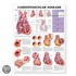 Cardiovascular Disease Anatomical Chart