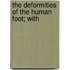 The Deformities Of The Human Foot; With
