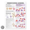 Understanding Leukemia Anatomical Chart door Anatomical Chart Company