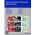 Atlas Of Acoustic Neurinoma Microsurgery