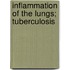 Inflammation Of The Lungs; Tuberculosis