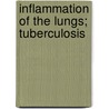 Inflammation Of The Lungs; Tuberculosis door Ludwig Buhl