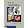 Mayo Clin Chal Image Pul Board Rev Cdrom door Iii Rosenow Edward C.