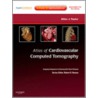 Atlas of Cardiovascular Computed Tomography door Allen Taylor