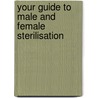 Your Guide To Male And Female Sterilisation door Onbekend