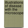 Illustrations of Disease with the Microscope door Francis Peyre Porcher