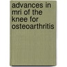 Advances In Mri Of The Knee For Osteoarthritis door Majumdar