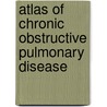 Atlas of Chronic Obstructive Pulmonary Disease door Onbekend