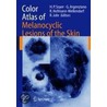 Color Atlas Of Melanocytic Lesions Of The Skin door Soyer