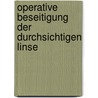 Operative Beseitigung Der Durchsichtigen Linse by Ernst Pfl�Ger