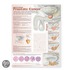 Understanding Prostate Cancer Anatomical Chart
