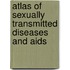 Atlas Of Sexually Transmitted Diseases And Aids