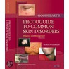 Goodheart's Photoguide to Common Skin Disorders by Herbert P. Goodheart