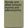 Fibroids And Allied Tumours Myoma And Adenomyoma door Cuthbert Lockyer