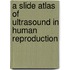 A Slide Atlas Of Ultrasound In Human Reproduction