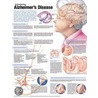 Understanding Alzheimer's Disease Anatomical Chart by Anatomical Chart Company