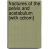 Fractures Of The Pelvis And Acetabulum [with Cdrom] door Marvin Tile