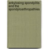 Ankylosing Spondylitis and the Spondyloarthropathies door Michael Weisman